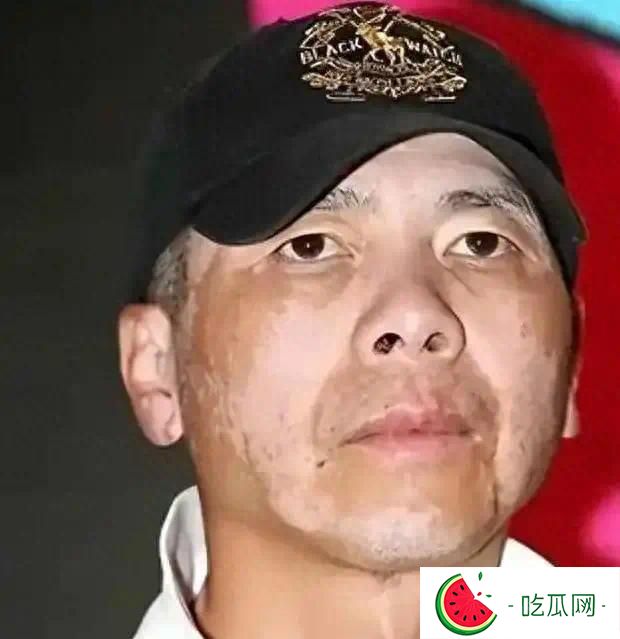 冯小刚病情恶化,身价上亿却选择放弃治疗,徐帆含泪说:钱多有啥用