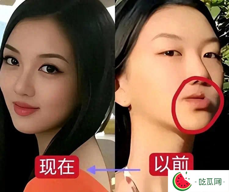 去掉兔唇后的李嫣惊为天人，果然，有王菲李亚鹏当爸妈就是不一样