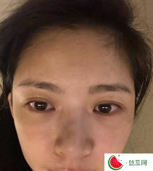 杜淳妻子晒素颜美照，37岁冻龄如少女，紧致肌肤令人羡慕！