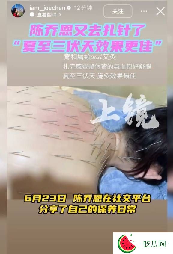 陈乔恩分享夏至养生实录：赶在三伏天扎针施灸，直呼 "效果更佳"
