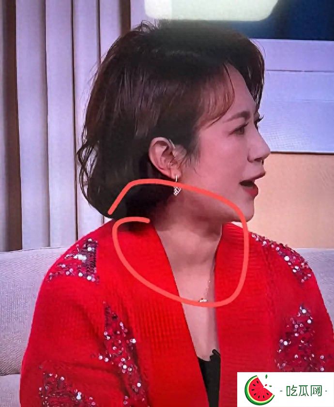 马丽被网友发现甲状腺有问题 本尊曾回应称有结节并无大碍
