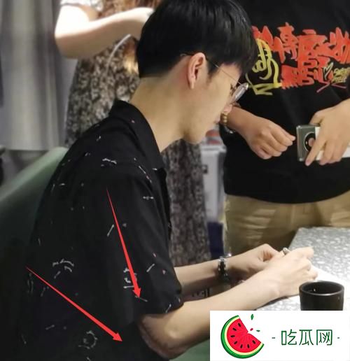 TheShy手为什么受伤？原因是喝完酒跟垃圾桶干上了？