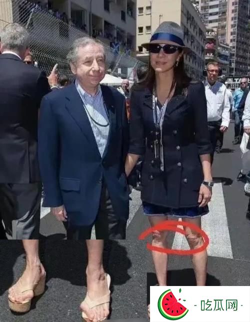 杨紫琼脚趾头外翻近照图片，是什么原因造成的？