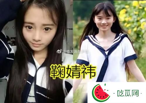 鞠婧祎究竟有没有整容呀(鞠婧祎早期照片和现在对比图)