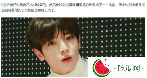 李泰容眼角的疤怎么弄的(李泰容是NCT哪个队的)